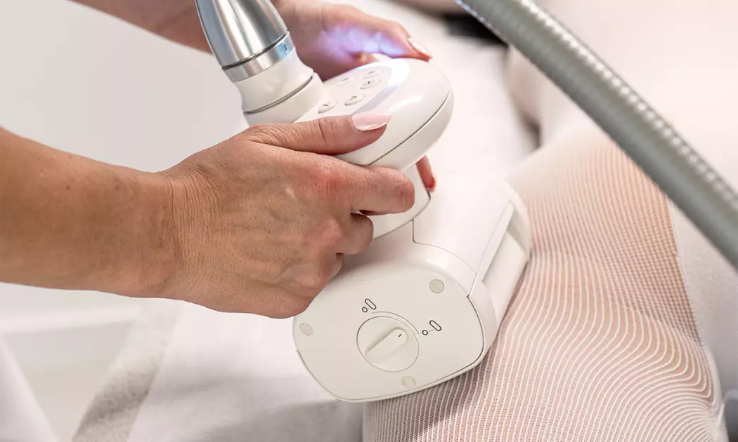 Endermologia antycellulitowa LPG® Alliance: 1 lub 10 zabiegów