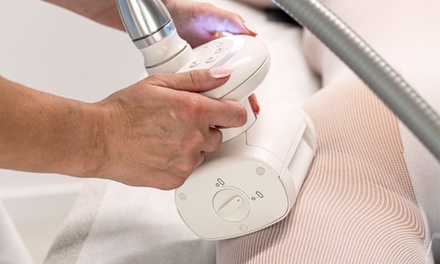 Endermologia antycellulitowa LPG® Alliance: 1 zabieg
