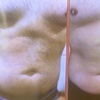 Image 3: Transform Your Body with Two or Four Laser Liposuction Sessions