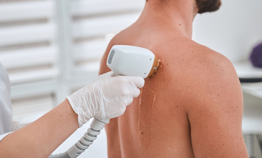 Image 2: Up to 50% Off on Laser Hair Removal at Modern Wellness & Beauty