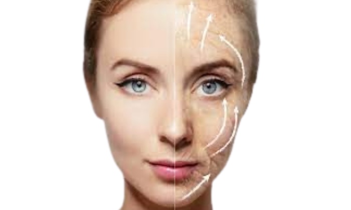 Up to 28% Off on Facelift - Non-Surgical at Beauty Bae Studio