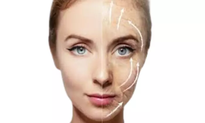 Up to 28% Off on Facelift - Non-Surgical at Beauty Bae Studio