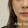 Image 3: 35% Off Sculptra or Radiesse at One Beauty Aesthetics