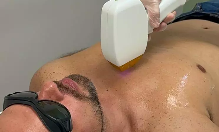 Six Laser Hair-Removal Sessions on Various Areas