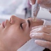 Image 2: Bis zu 50% Rabatt auf Micro-Needling bei Glow Spot