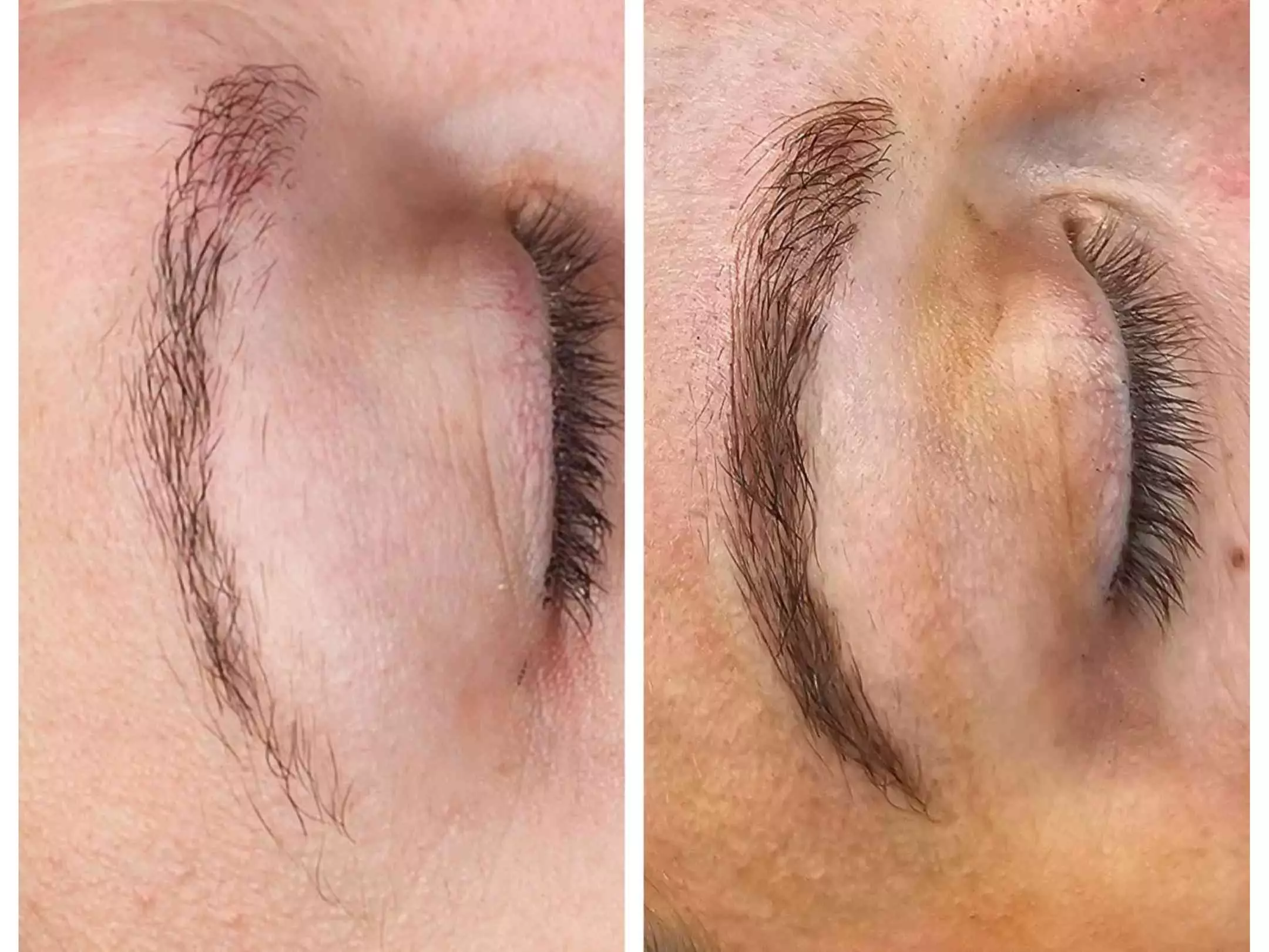 Perfect Brows with One Microblading Session with or without Touch-Up