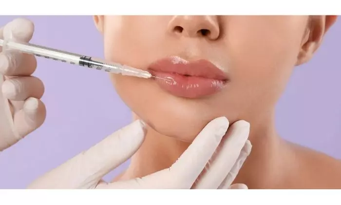 Enhance Your Look with Half (0.5 mL) or Full (1.0 mL) Syringe of RHA 3