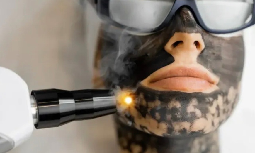 Image 2: Up to 37% Off on Facial - Pore Care at Mynd Spa
