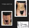 Up to 53% Off on Lymphatic Drainage Massage at Shapes Lymphatic