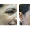 Image 3: Refresh Yourself with Xeomin Shots