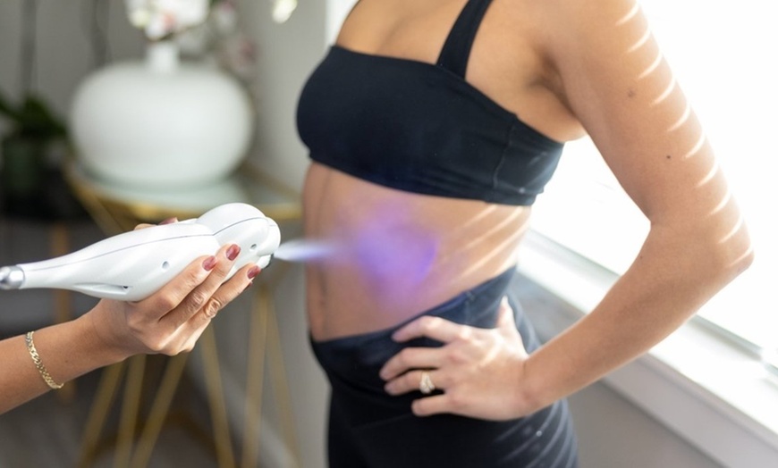 Image 2: Cryoslimming for Stubborn Abdominal Fat: No Surgery, No Downtime