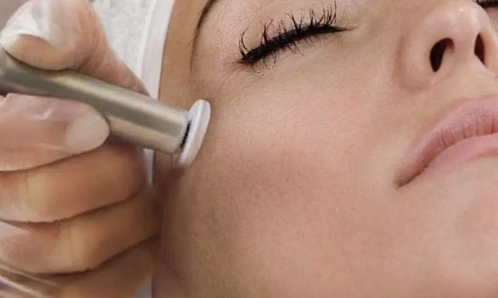 Transform Your Skin at Body By Shae: Enjoy Up to 50% Off Microdermabrasion with Cryo Therapy & Nano Infusion - Primary Image