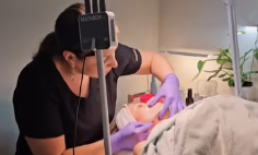 Image 3: Dermaplaning Facial Packages for Smooth, Glowing Skin