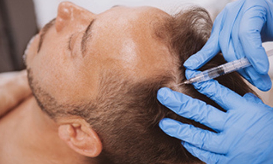 Image 2: Tailored Treatments for Hairline, Half Scalp, or Full Head