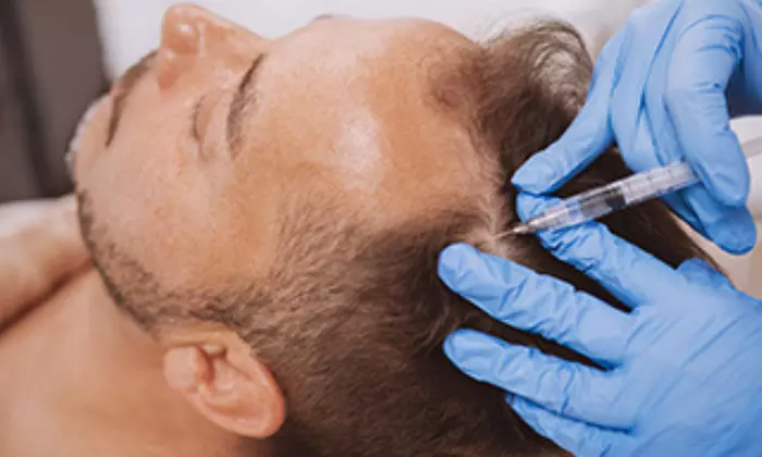 Tailored Treatments for Hairline, Half Scalp, or Full Head