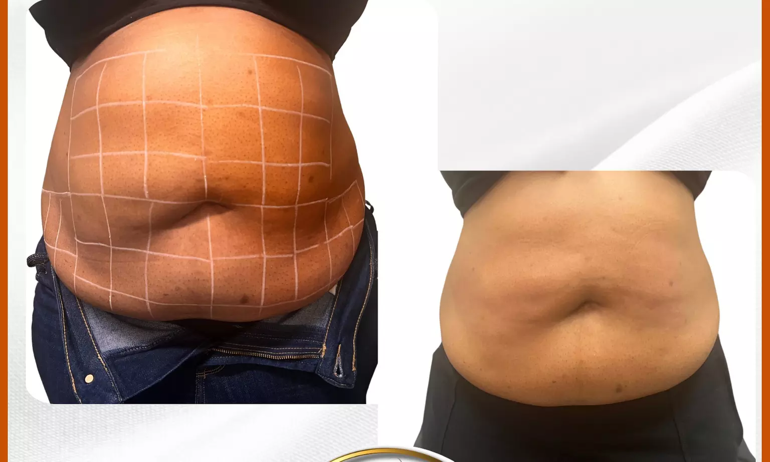 Up to 53% Off on Lymphatic Drainage Massage at Dream Bodyworks Llc