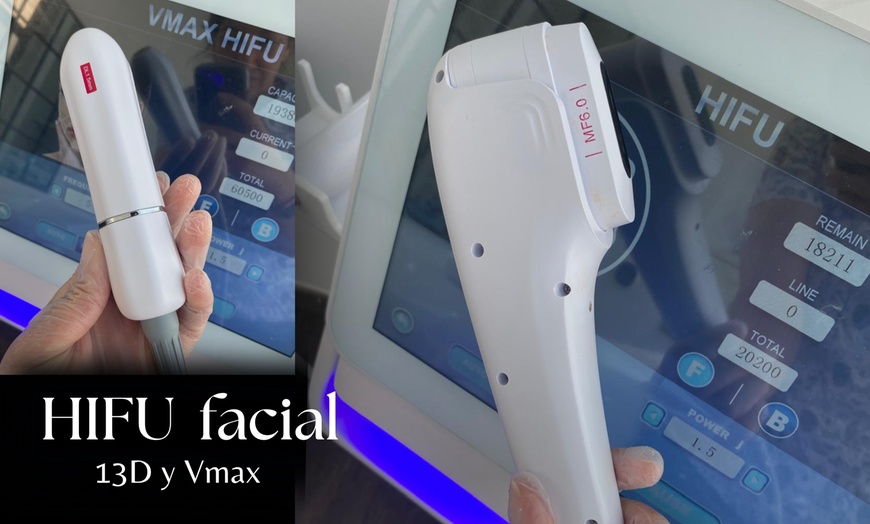 Image 6: Tratamiento HIFU facial o zona corporal con opción a radiofrecuencia
