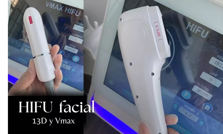 Image 6: Tratamiento HIFU facial o zona corporal con opción a radiofrecuencia