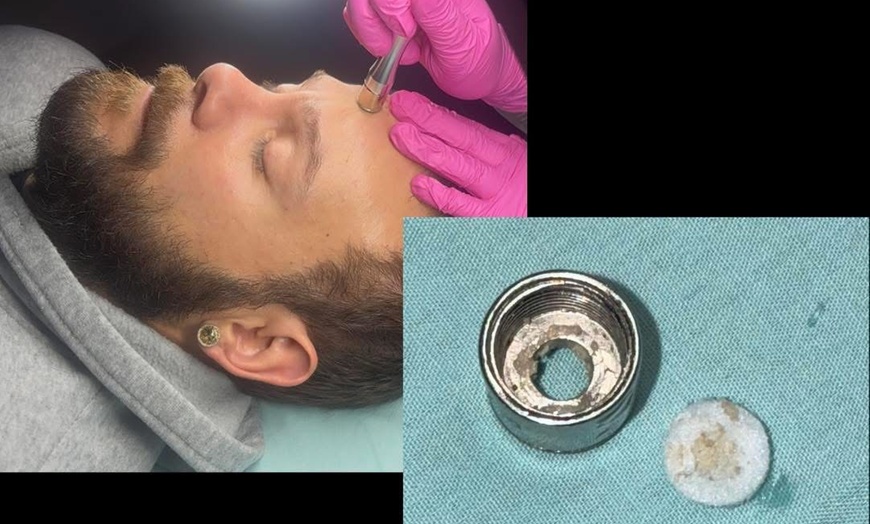 Image 3: Up to 30% Off on Waxing at A.Esthetics