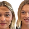 Image 2: Up to 33% Off on Injectables at Hush Aesthetics, LLC