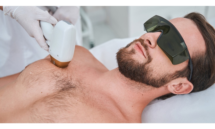 Image 9: 6 Laser Hair Removal Sessions on X-Small, Small, Medium, or Large Area