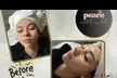 One, Two, or Three 60-Minute Classic or Microdermabrasion Facial Sessions at Peace Esthetics Lab - Up to 61% Off - Second Medium