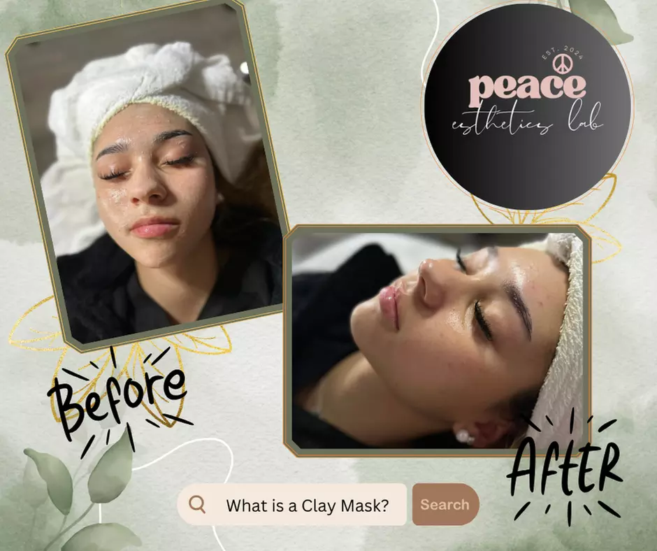 One, Two, or Three 60-Min Classic or Microdermabrasion Facial Sessions