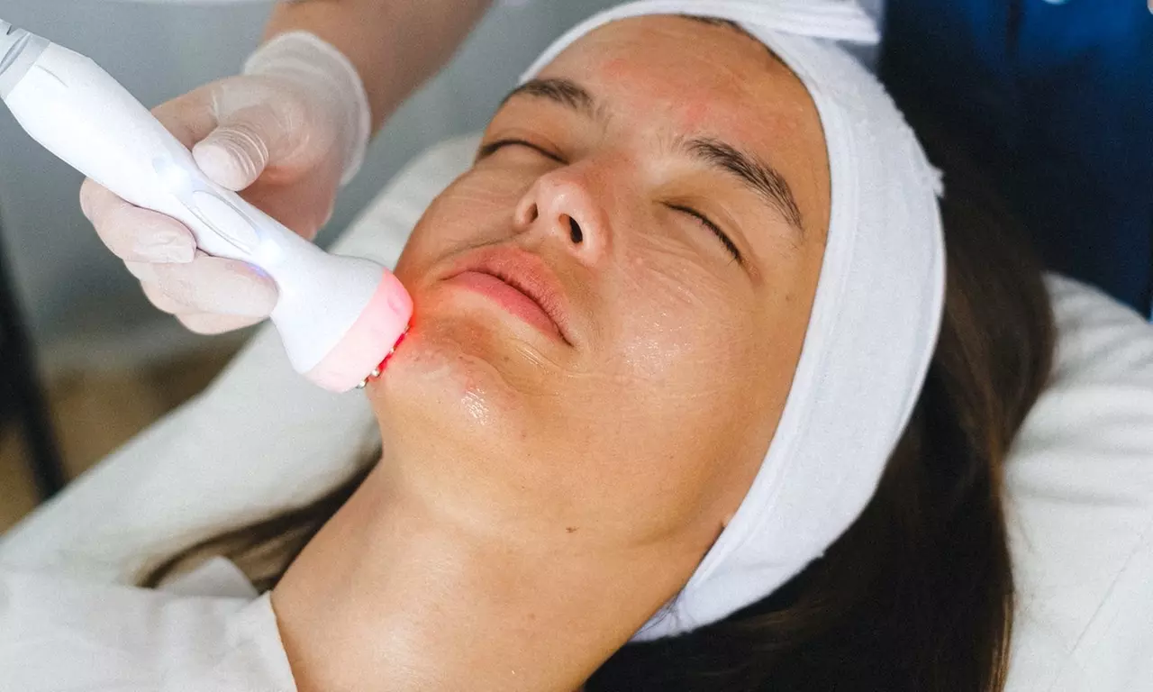 Up to 47% Off on Exfoliating Facial at Mongael Aesthetics - Primary Image