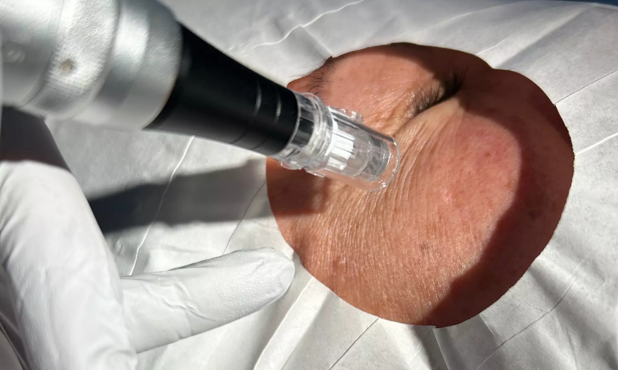 Rejuvenate with Anti-Aging Stem Facial Treatments