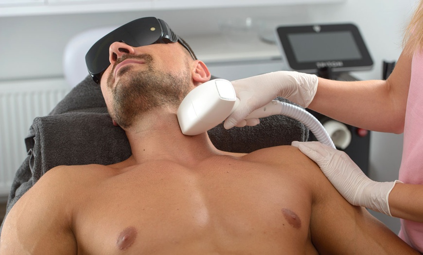 Image 3: Up to 55% Off on Laser Hair Removal - Men at UK Aesthetics Lounge