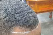 One or Two Scalp Micro-pigmentation Hair Loss Treatment
 Up to 37% Off - Second Medium