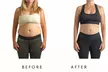 Precision Slim Laser Fat Loss & Skin Tightening – Non-Invasive Body Contouring Up to 58% Off at Your Sculpt Studio DC - Second Medium
