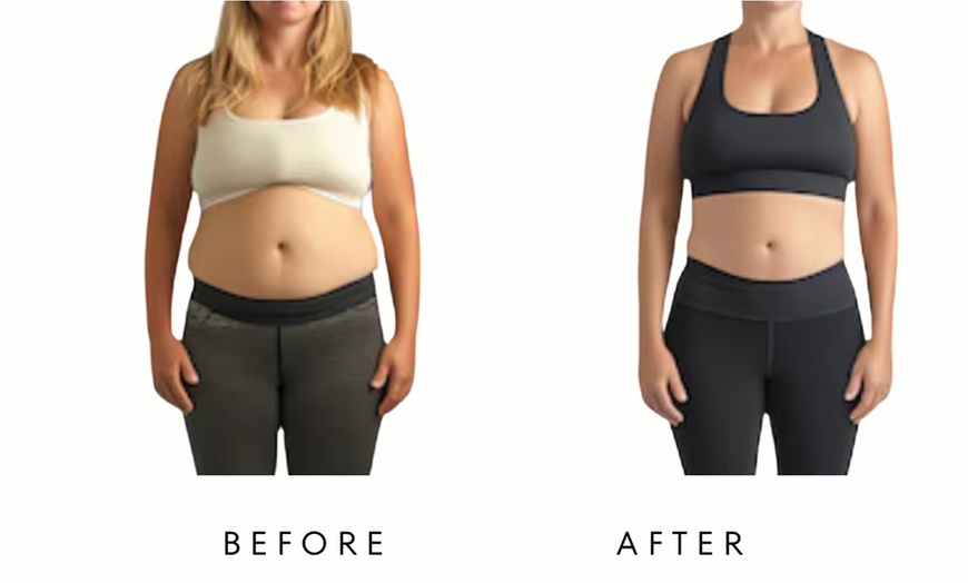 Image 2: Precision Slim Laser Fat Loss & Skin Tightening, Your Sculpt Studio DC