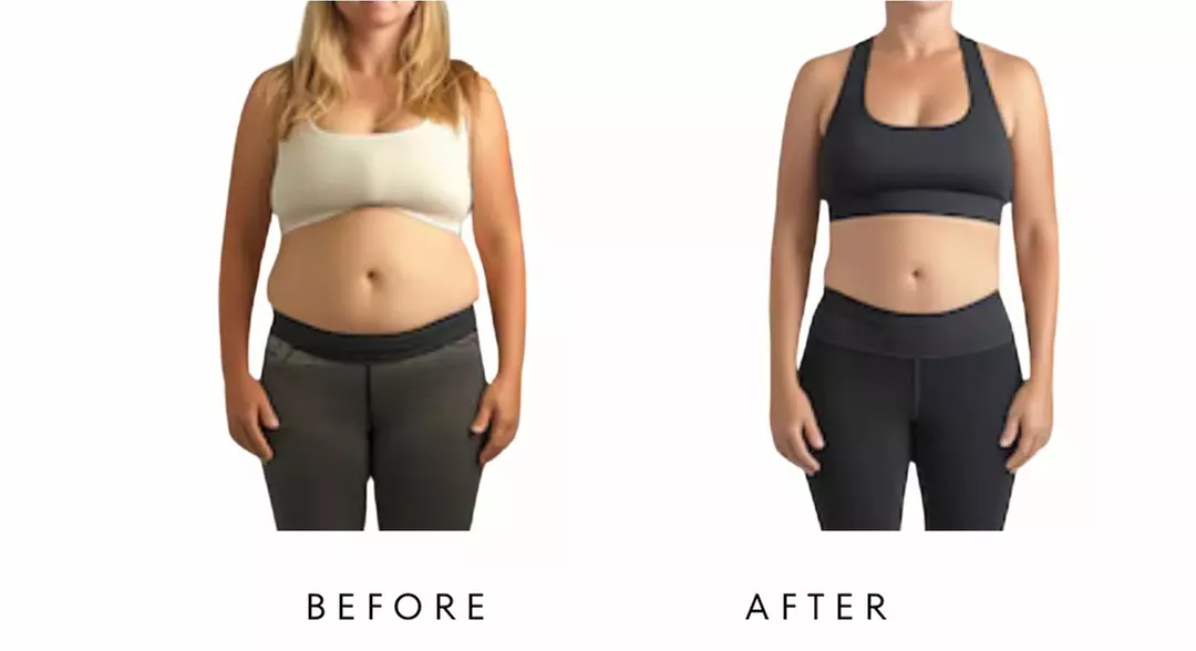 Precision Slim Laser Fat Loss & Skin Tightening, Your Sculpt Studio DC