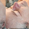 Image 3: Up to 55% Off on HydroFacials + LED Therapy
