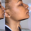 Image 3: Redefine Body with One, Four or Eight Fat Reduction Sessions