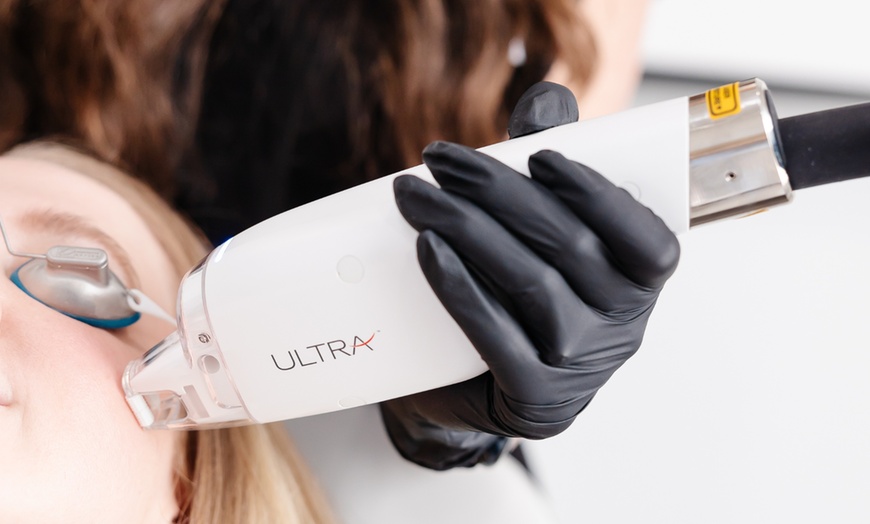 Image 5: Non-Ablative Fractional Laser - LaseMD Ultra for Stretch Marks, Face, Neck, or Hands at Loma Laser (Up to  45% Off)