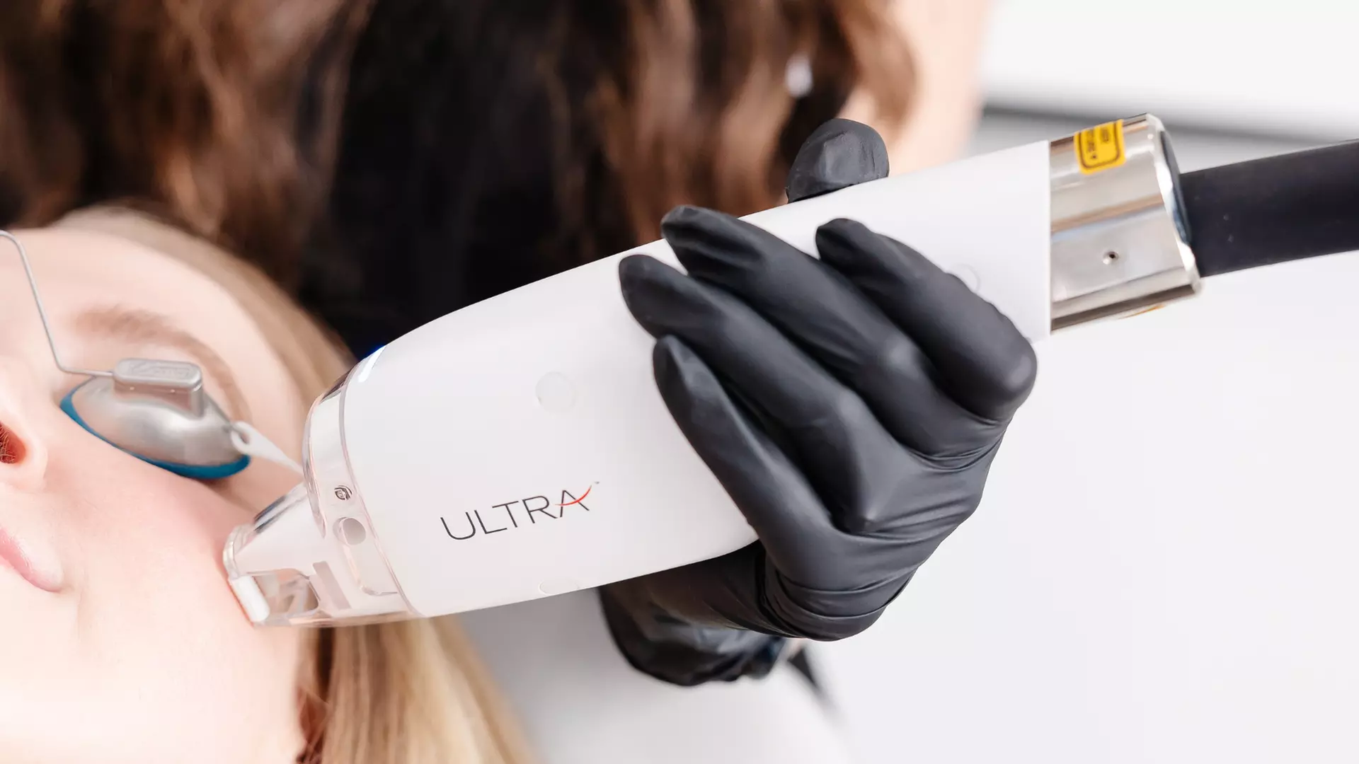 Non-Ablative Fractional Laser - LaseMD Ultra for Stretch Marks, Face, Neck, or Hands at Loma Laser (Up to  45% Off) - Second Medium