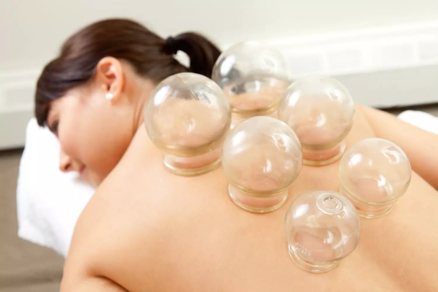 Experience Acupuncture with a Single Session