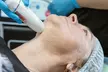 Achieve Youthful Skin with Advanced Non-Surgical HIFU Facelift at Re:Glow Beauty (Up to 63% Off) - Second Medium