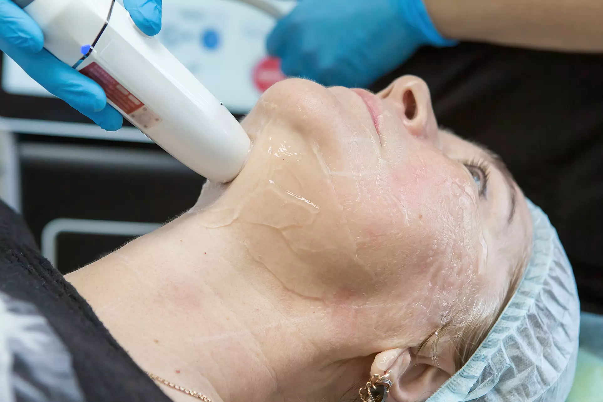 Skin Tightening & Lifting with Advanced Non-Surgical HIFU Facelift