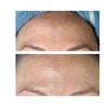Image 5: Up to 55% Off on Facial - Chosen by Customer at Rise Skin Spa