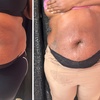 Image 4: Up to 37% Off on Cavitation at Extreme body sculpting