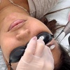 Image 1: Up to 71% Off on Tattoo Removal at HL Lasers