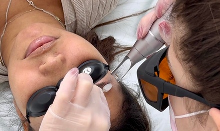 Laser Eyebrow Pigment Removal - HL Lasers