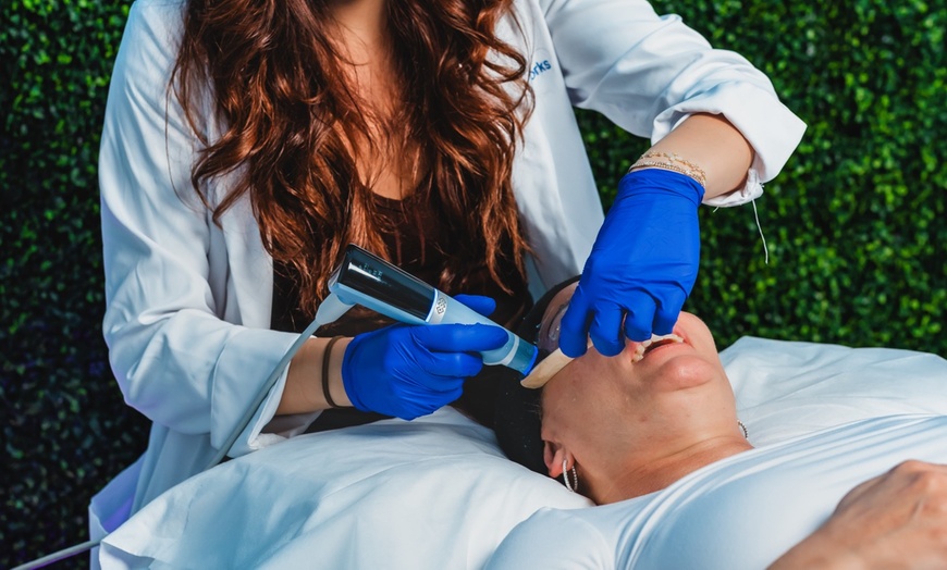 Image 2: Radio Frequency Skin Tightening Session w/ Ultrasound / Microneedling
