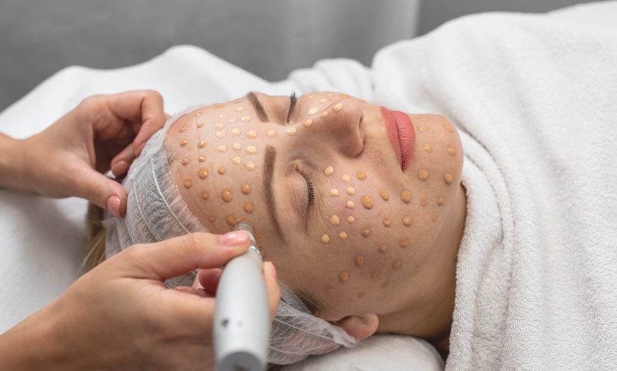 Image 1: Revitalize Your Skin with One, Two, or Three BB Glow Facial Sessions