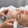Image 1: Revitalize Your Skin with One, Two, or Three BB Glow Facial Sessions