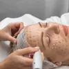 Image 1: Revitalize Your Skin with One, Two, or Three BB Glow Facial Sessions