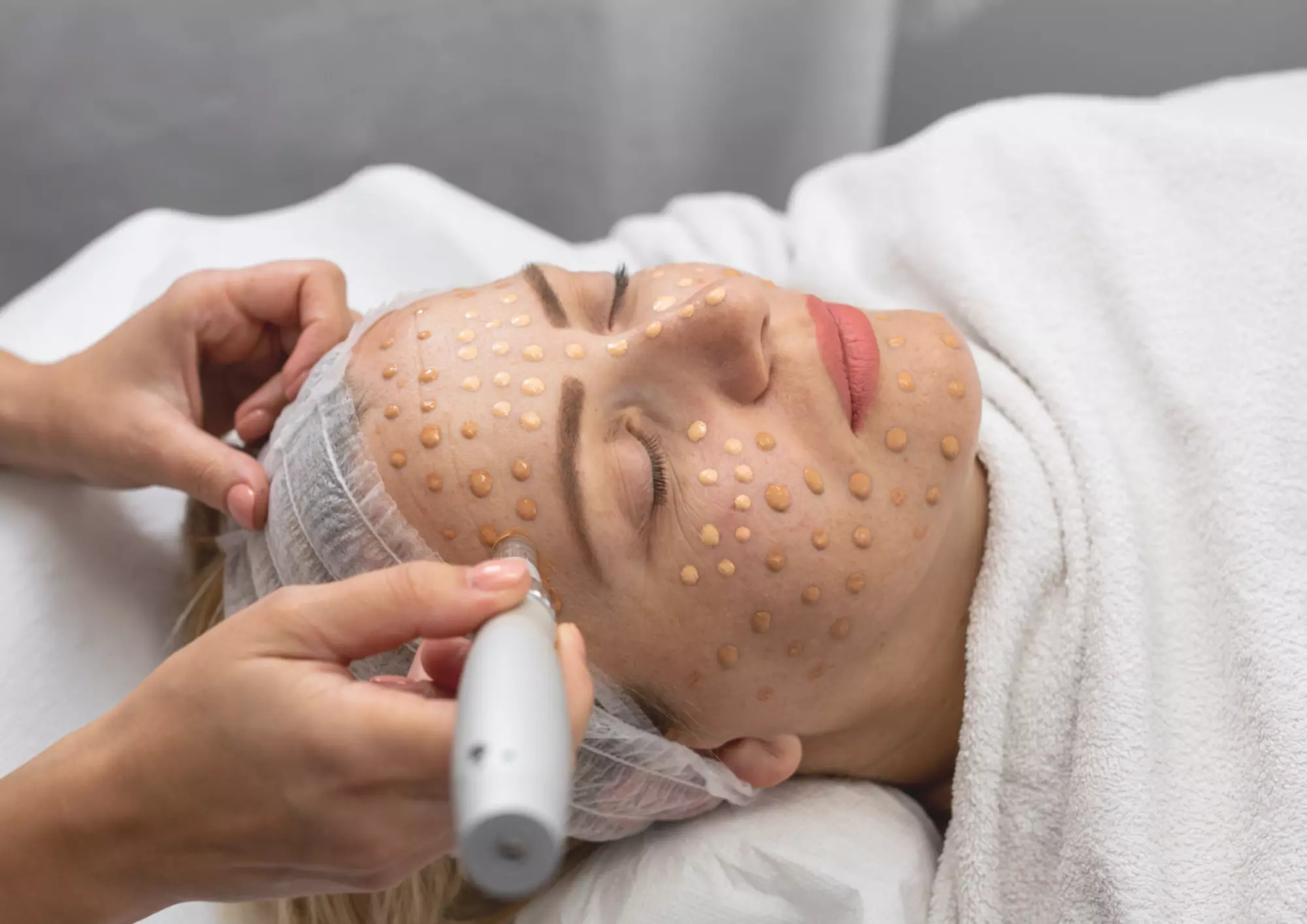 Revitalize Your Skin with One, Two, or Three BB Glow Facial Sessions at Organik Laser & Beauty (Up to 60% Off) - Primary Image